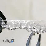 ارتودنسی دکتر الهام مرادی | ارتودنسی بدون سیم | دندانپزشک اطفال