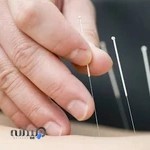 فیزیوتراپی نارمک