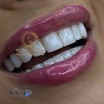 دندانپزشکی شرق تهران