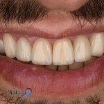 دکتر پویا جنتی - متخصص پروتزهای دندانی