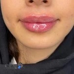 پوست مو لیزرالنا