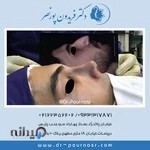 دکتر فریدون پورنصر(جراح زیبایی بینی)