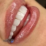 دندانپزشکی زیبایی دکتر آزاده قاسمی