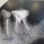 دکتر علی نوحه خوان، دندانپزشک، متخصص جراحی و درمان ریشه دندان (اندودانتیست)