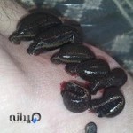 مرکز حجامت و زالودرمانی و طب سنتی