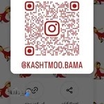 کاشت مو باما