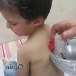 مرکز حجامت طب سوزنی وسنتی دکترمحمودانتظاری