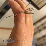 Movahedi Physical Therapist