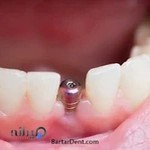 زیبایی برتر