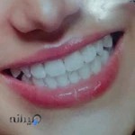 دندانسازی نصراللهی