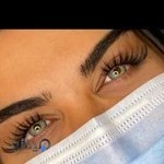 کاشت مژه کرمانشاه