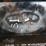 دکتر محمود زلکی زاده