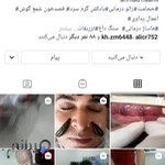 طب سنتی حجامت