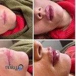 ( کلینیک زیبایی نیلا ( دکتر معتمدآریا