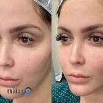 کلینیک زیبایی بنیتا تهرانپارس