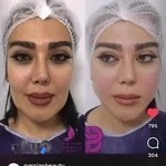 پارسیان بیوتی صدر