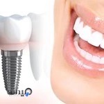 کلینیک دندانپزشکی اقساطی حامی
