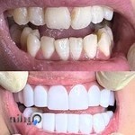 دندانپزشکی(دکتر رسول حاجی زاده. جراح دندانپزشک)