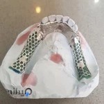 دندانسازی ملازهی