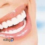 دندانپزشکی درتیس