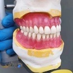 دندانسازی منهی