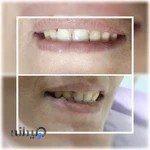 دندانپزشکی لبخند