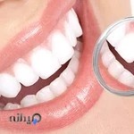 دکتر علی شیران - جراح و دندانپزشک،زیبایی و ایمپلنت