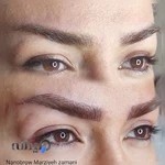 میکروبلیدینگ ابرو