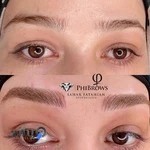 میکروبلیدینگ و میکروپیگمنتیشن فتاحیان