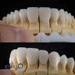 دندانپزشکی دکتر مریم اسماعیل زاده