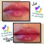 کلینیک زیبایی راز