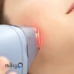 شرکت تجهیزات پزشکی نیک لیزر