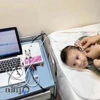 شنوایی سنجی نوزاد