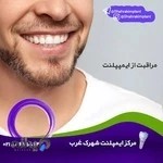مرکز ایمپلنت شهرک غرب