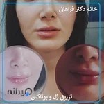 مطب دکتر فراهانی