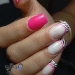 مرکز کاشت ناخن