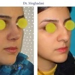 دکتر مقدسی - تبریز (E.N.T - Rhinoplasty )