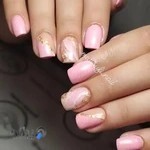 کلینیک کاشت ناخن