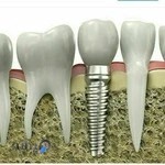 دندانپزشکی دکتر قاسمیه