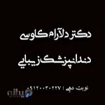 کامپوزیت ونیر ‌