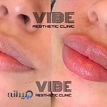 کلینیک پوست،مو و زیبایی وایب