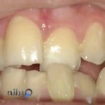 رادیولوژی و بخش دندان پزشکی فرهنگیان