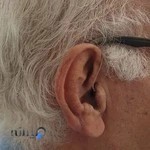 کلینیک سنجش شنوایی فاطمه قربانی(سمعک اول )