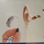 سمعک سایه کرج