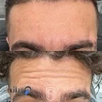 کلینیک پوست مو لیزر ستاره