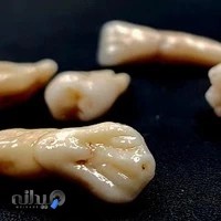 دندانسازی خوشباف