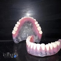 دندانسازی سوری