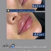 کلینیک زیبایی الین مشهد