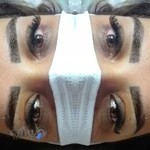 کاشت و اکستنشن مژه