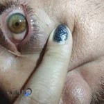 مجتمع چشم پزشکی نور